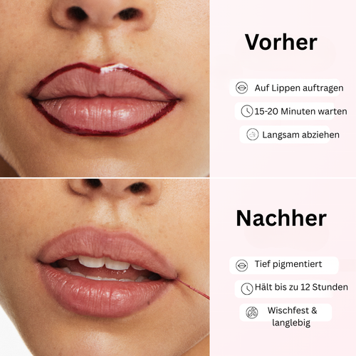 Kiss & Peel - Dein neuer Kiss Look